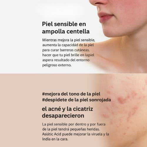 Madagascar Centella SKIN1004